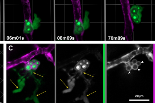 microglia