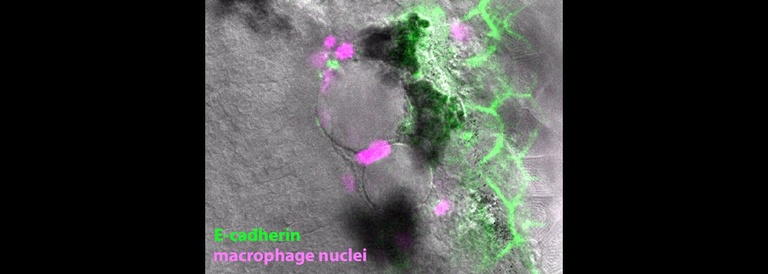 E-cadherin macrophage nuclei