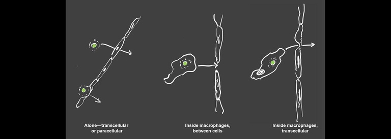 Potential mechanisms of brain invasion