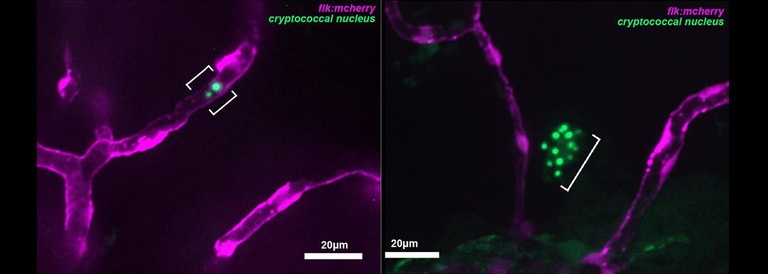 Cryptococcal Brain Invasion in vivo