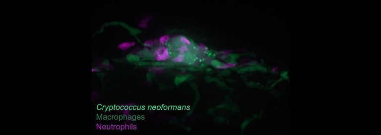 Clustered Macrophages in Cryptococcal Infection