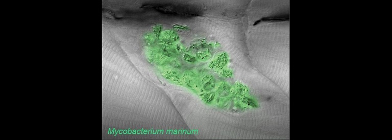 Cluster of macrophages infected with Mycobacterium marinum