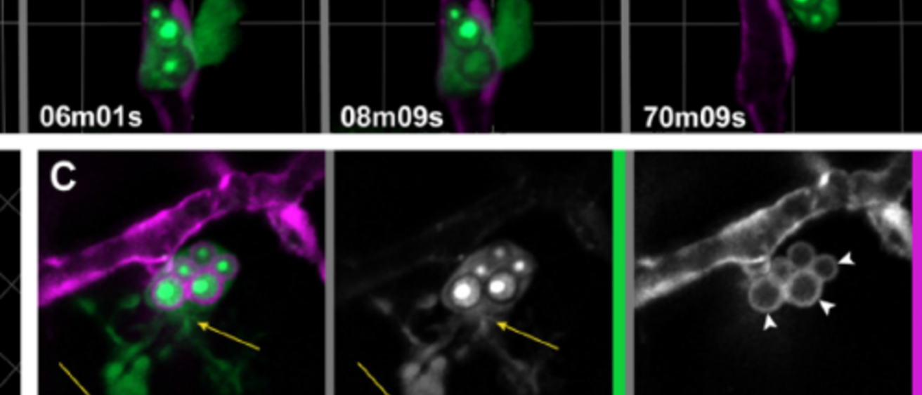 microglia
