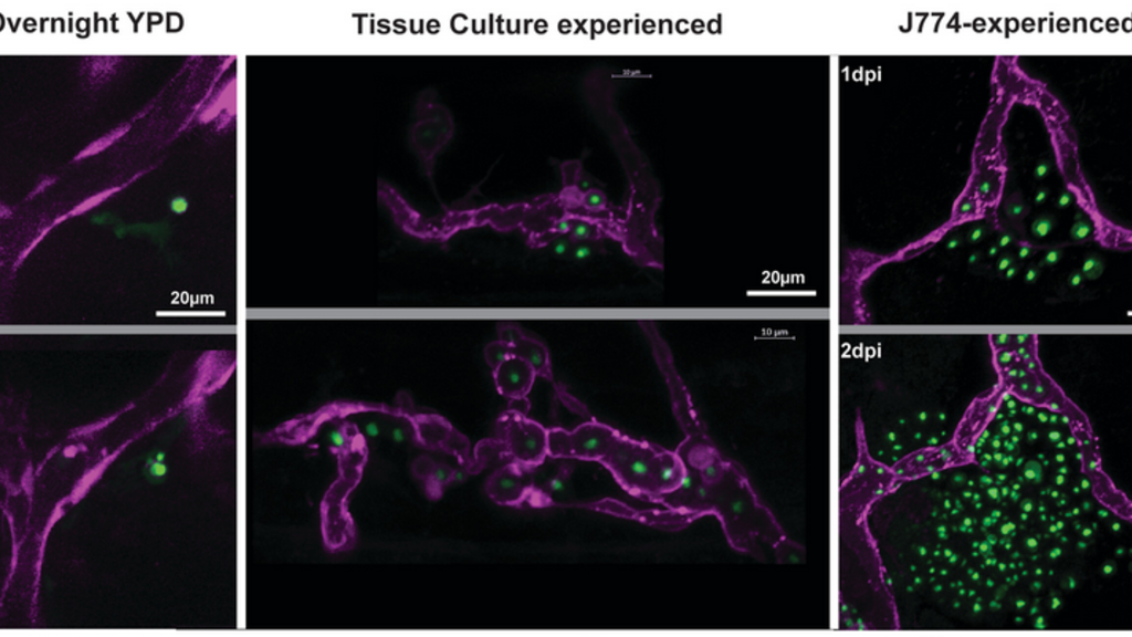 Cryptococcal expansion in the brain enhanced by macrophage pre-exposure