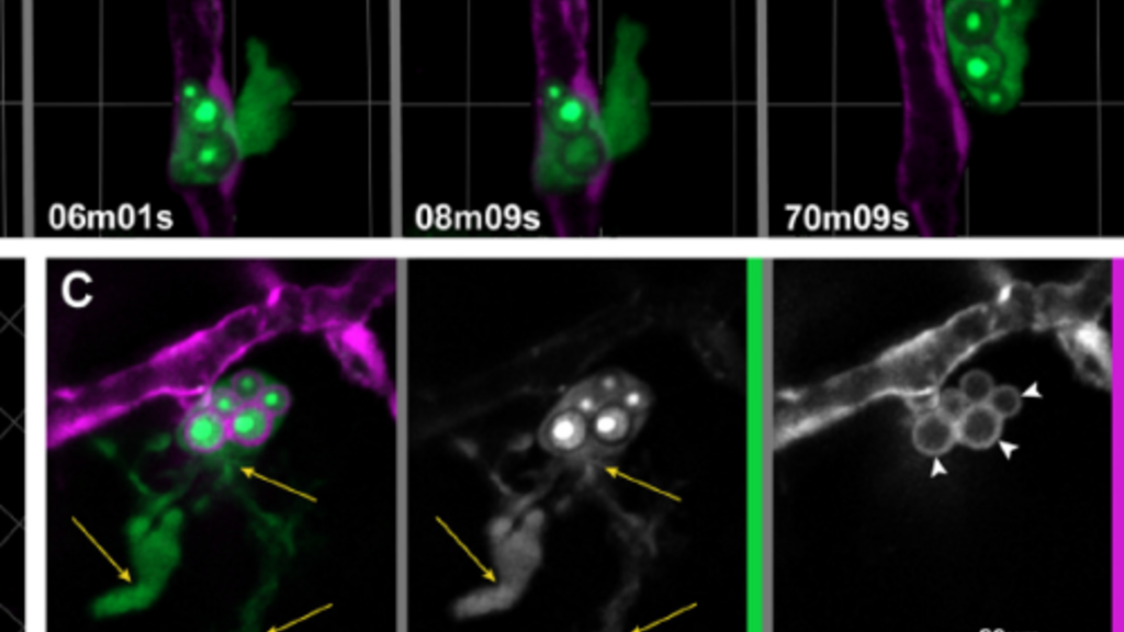microglia